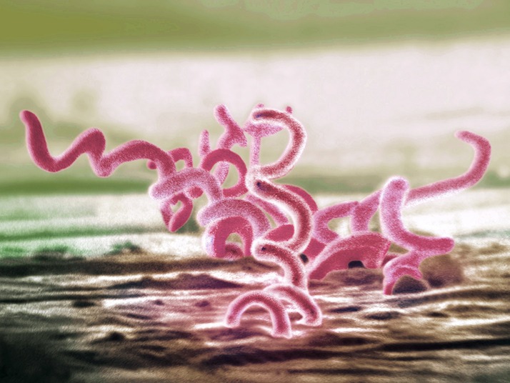 علائم سفلیس